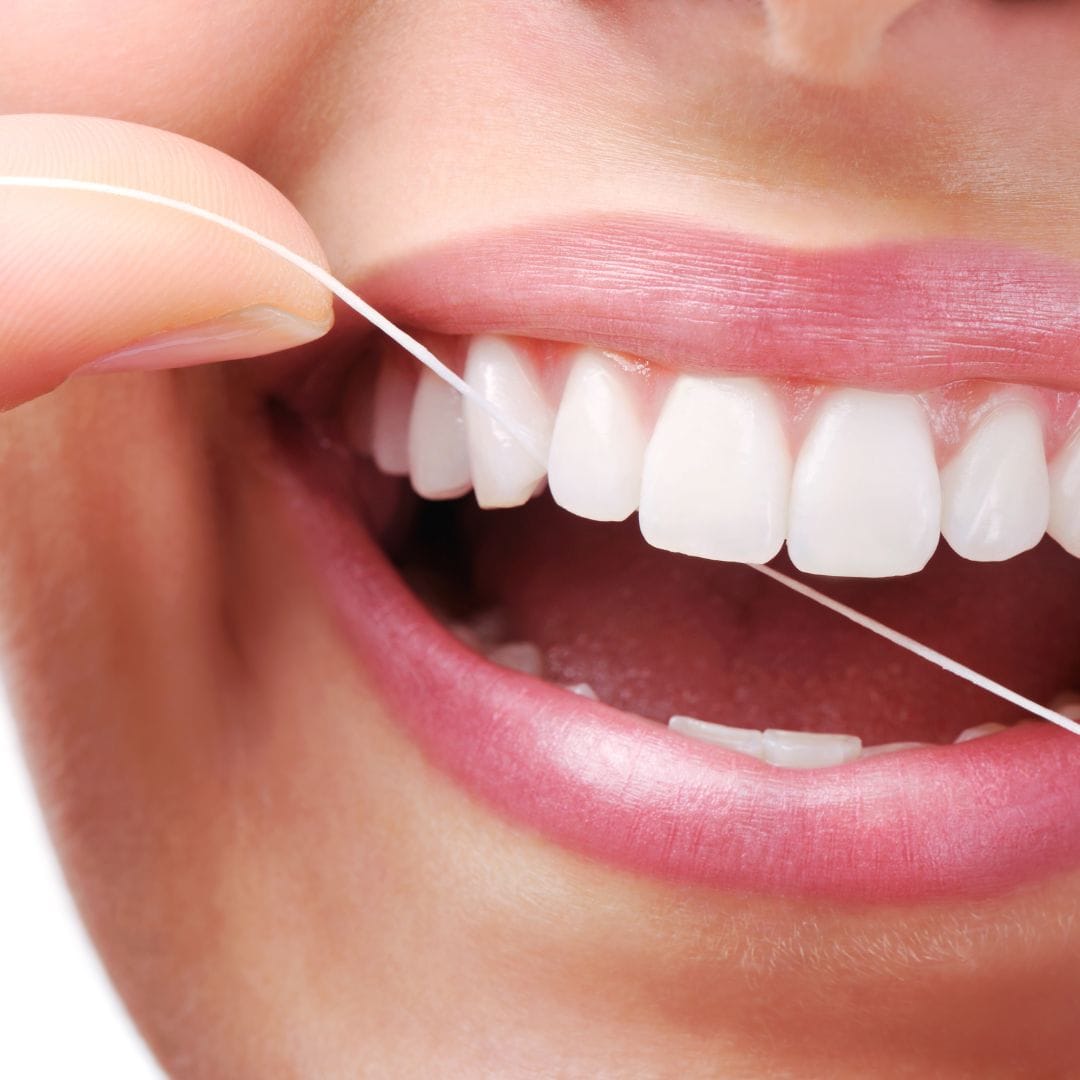 Warum Interdentalreinigung so wichtig ist