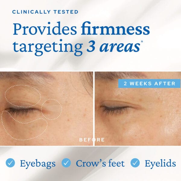 belif Moisturizing Eye Bomb 25ml - Eye cream with peptides, bakuchiol & caffeine against wrinkles & dark circles. Image with claim provides firmness targeting 3 areas, eyebags, crows feet, eyelids 