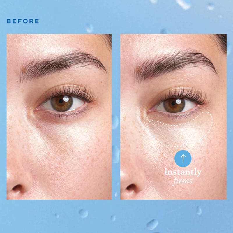 belif Aqua Bomb Depuffing Eye Gel 15ml – kühlendes Augengel mit Koffein, Hyaluronsäure & Niacinamid. Bild Vorher / Nachher.
