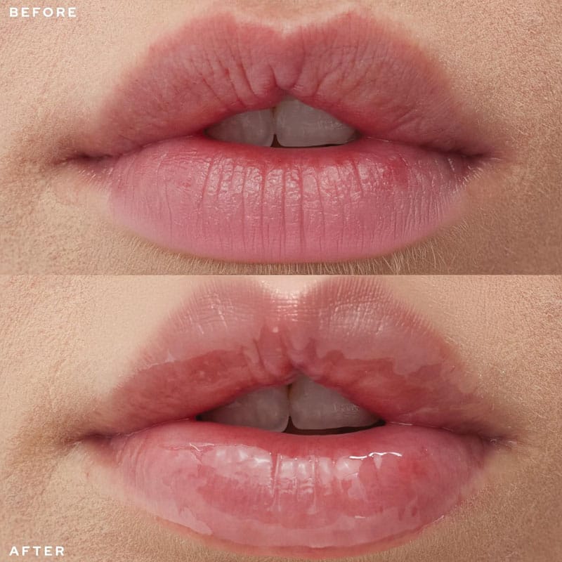 belif Mint Plumper Lipcerin 15ml – Aufpolsternder Lippenbalsam & Maske mit Minze, Peptiden und Multi-Vitamin-Komplex. Abbildung Infografik before and after